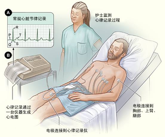 冠心病需要做哪些檢查？(圖1)