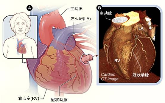 冠心病需要做哪些檢查？(圖2)